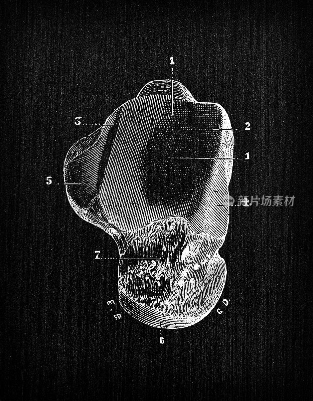 人体解剖骨骼的古董插图:距骨