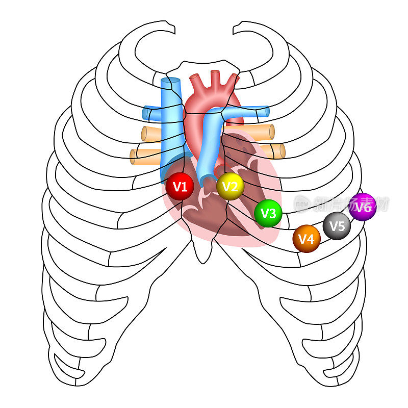 心电图胸部引线位置