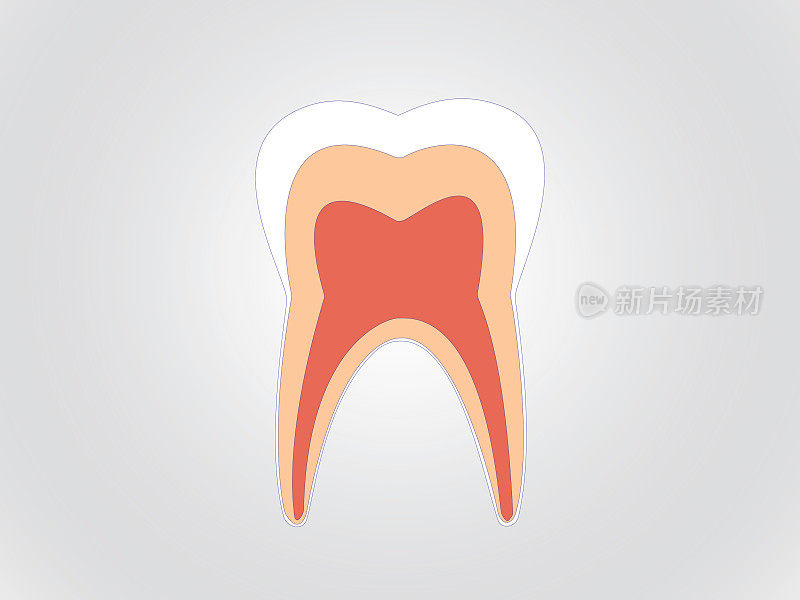 牙科诊所白牙分析