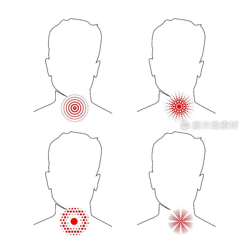 喉咙痛，抽象出人体与颈部疼痛位置的红色圆圈线