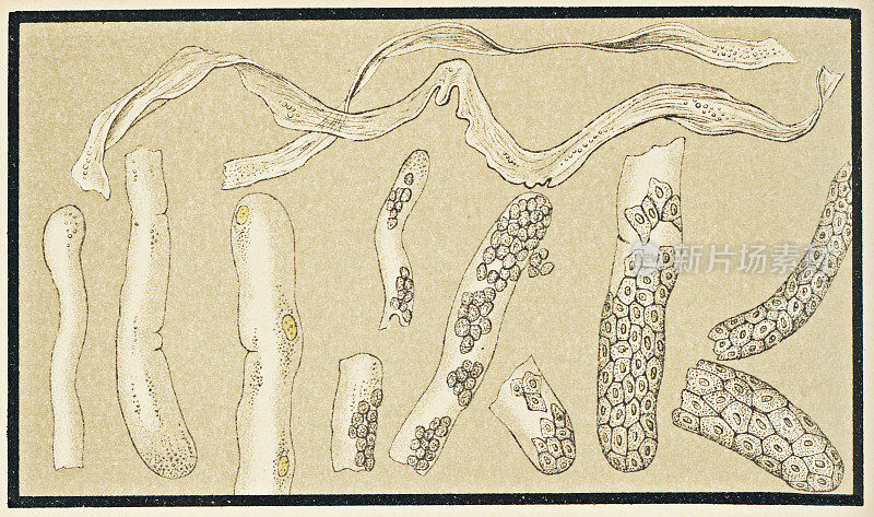 19世纪人类肾脏尿管的显微镜观察