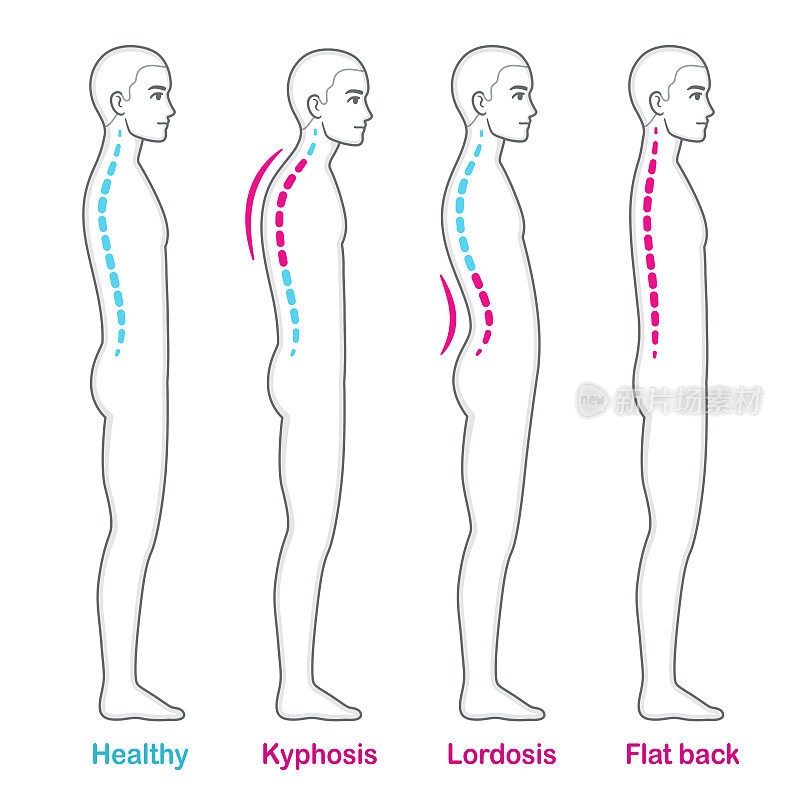 姿势和背部问题脊柱信息图