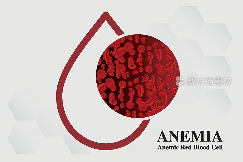 贫血铁血红细胞医学载体插图医学。