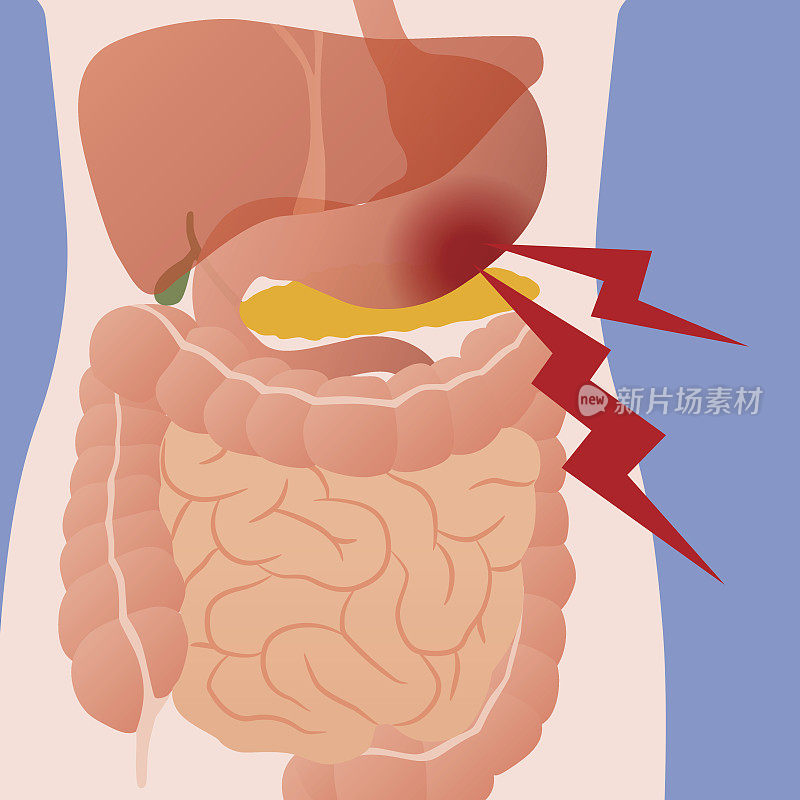 胃痛与人体消化器官，病媒说明