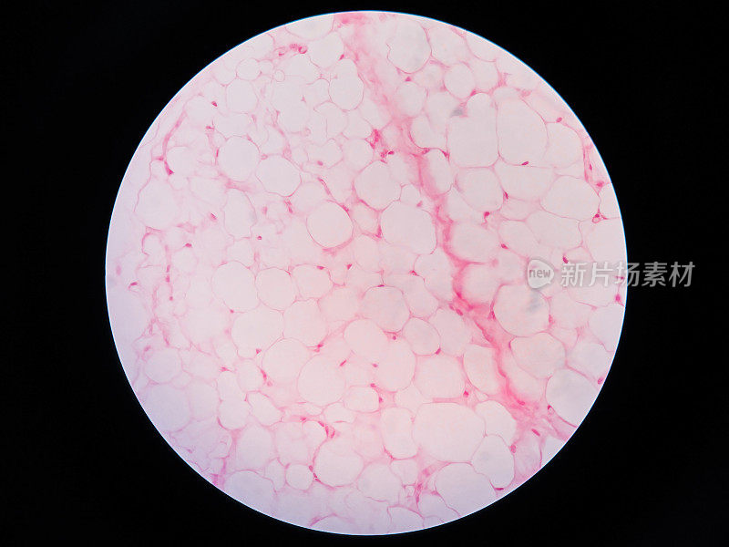显微镜下观察人体脂肪组织