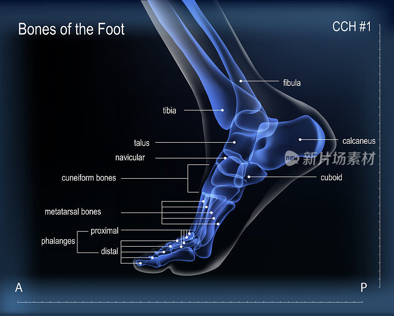足部骨骼的X光片。内侧的观点