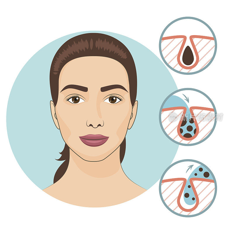 女人面部治疗。皮肤问题和面部护理矢量插图