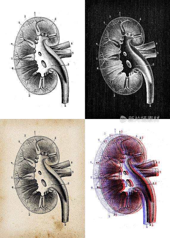 古董插图:肾