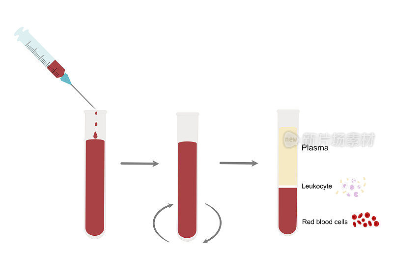 将外周血或全血离心，分离出血浆、白细胞或白细胞、红细胞或红细胞三层，用于目标检测或特异性诊断。