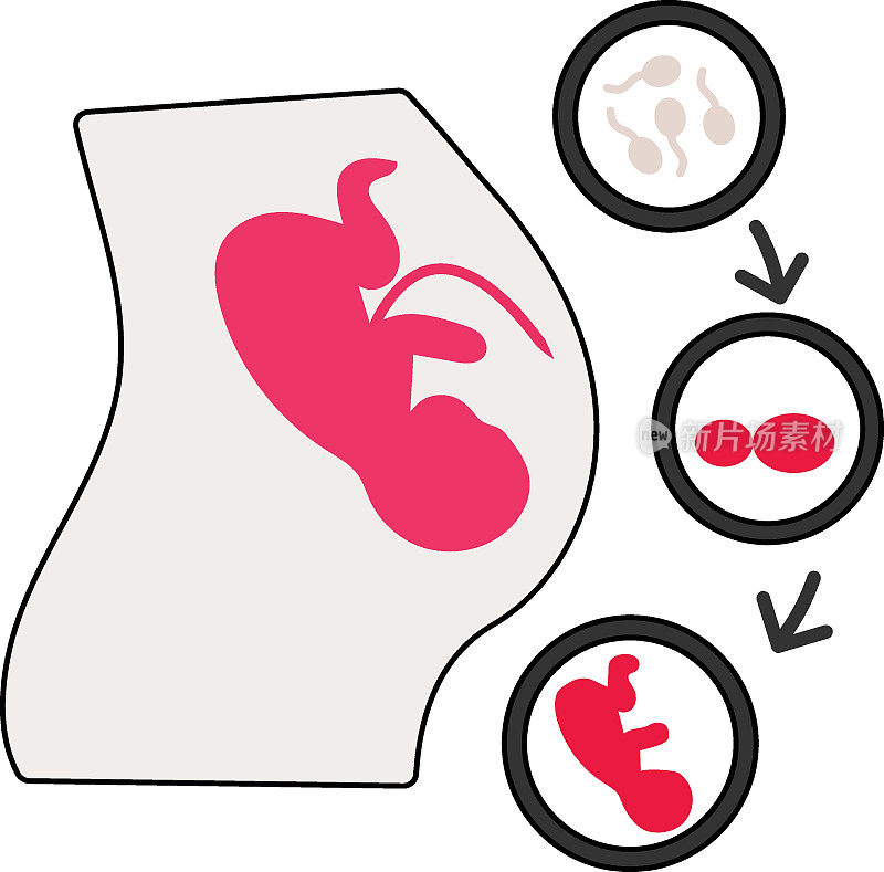 怀孕腹部体外受精过程矢量颜色图标设计，体外受精符号，怀孕和产科医生标志，试管婴儿程序库存插图，IVM过程和阶段的概念