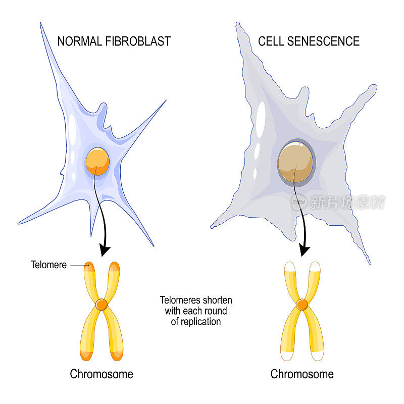 正常成纤维细胞染色体端粒与细胞衰老的关系。