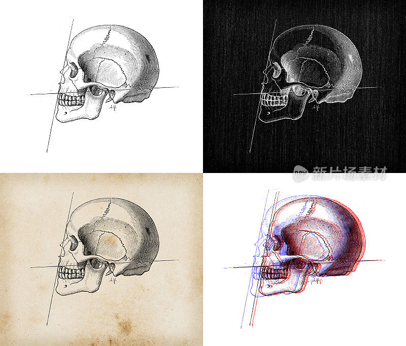古董插图:人类头骨
