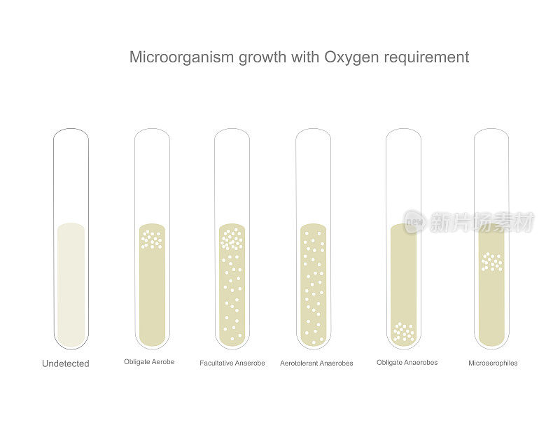 微生物需氧量生长的细菌鉴定，显示细菌类型:专性厌氧菌，兼性厌氧菌，耐氧厌氧菌，专性厌氧菌，嗜微微生物