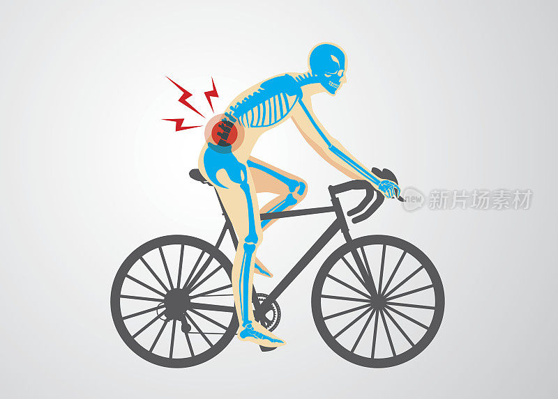 骑自行车的人脊椎疼痛