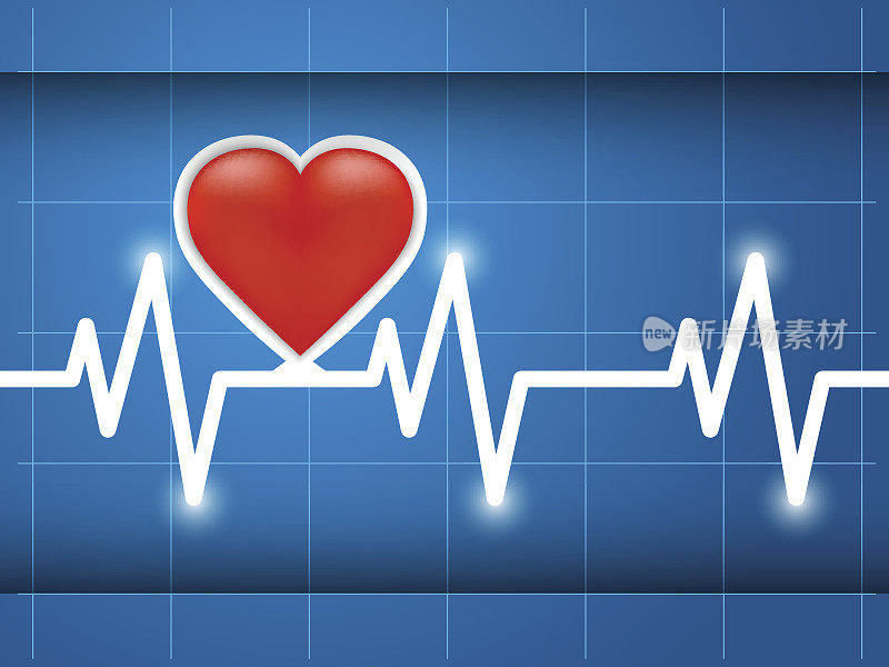 心电图心脏健康
