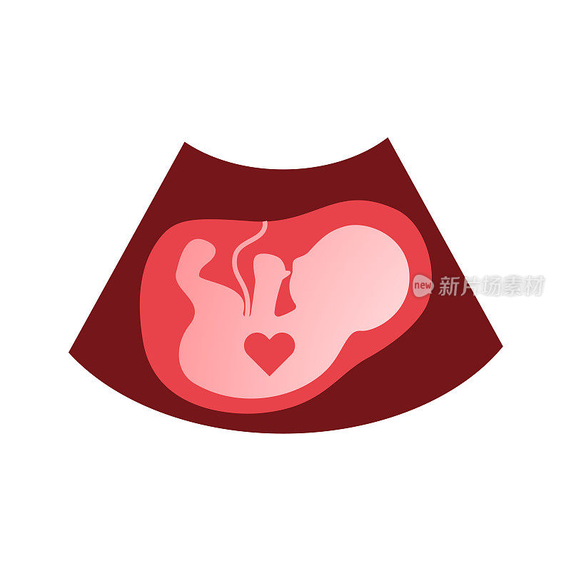胎儿红色超声图