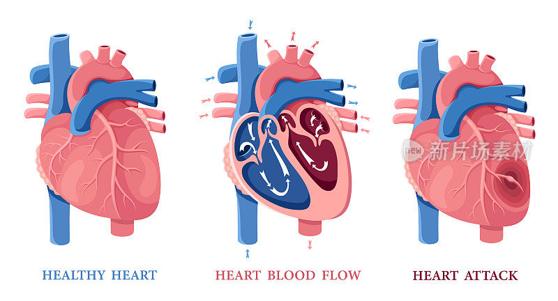 心脏健康。心脏血流。心脏病发作。人类心脏解剖学。