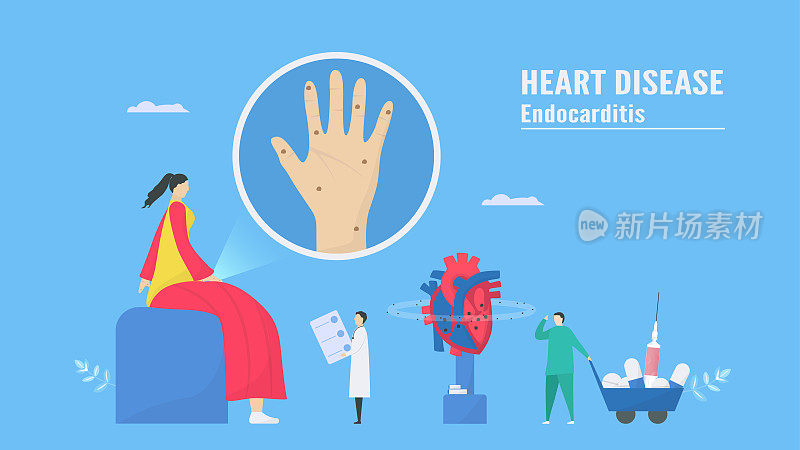 心脏病矢量插图。这种疾病叫做心内膜炎。它是心内膜感染，即心腔和瓣膜。奥斯勒节点在手边。医生诊断分析。