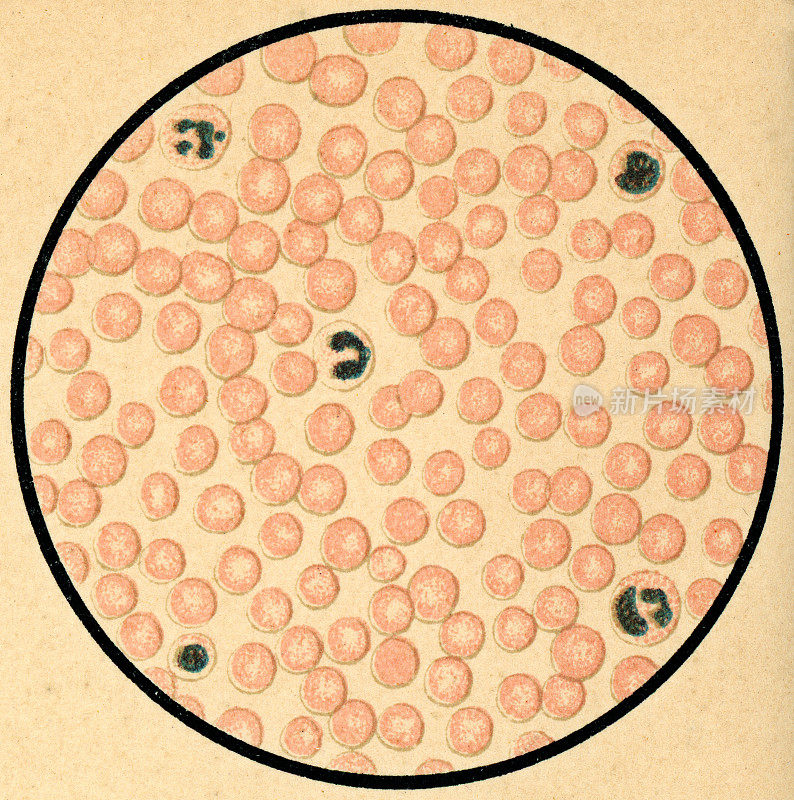 19世纪人类血细胞染色的显微镜观察