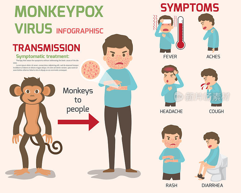 猴痘病毒信息图元素，人体有皮疹。疾病症状:淋巴结肿大，肌肉疼痛，发烧，头痛，皮疹。矢量插图。