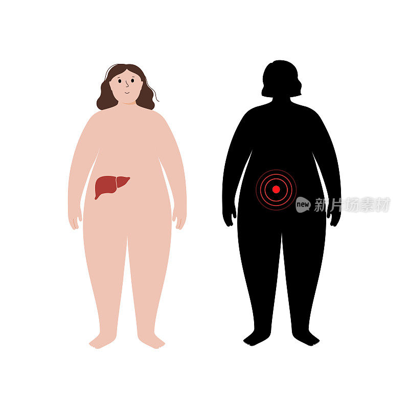 肥胖人体的器官