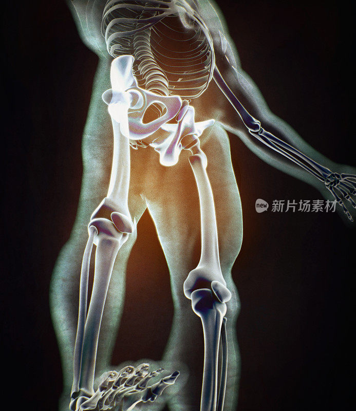 髂骨、髋骨、骨盆。人体解剖学，骨骼结构x光。