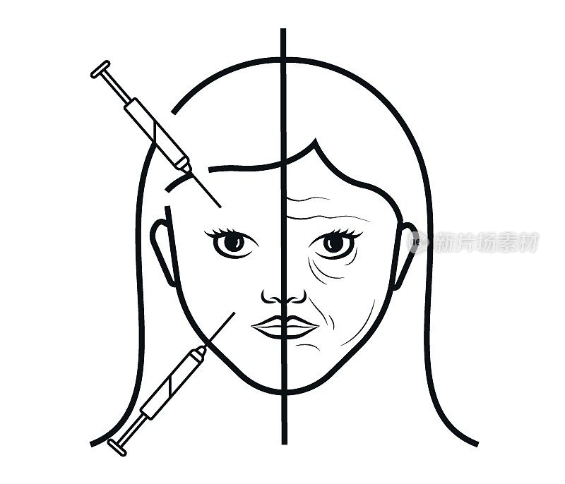 面部皱纹治疗前后。整容手术和肉毒杆菌。女性面部护理理念。