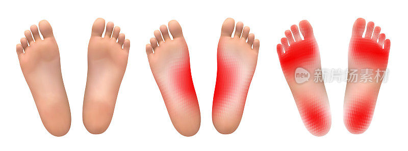 矢量组的腿与白色背景上的红色疼痛斑块