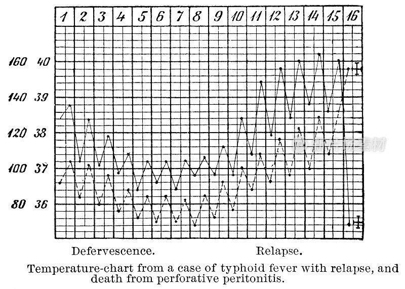 19世纪伤寒复发及最终死亡病人体温表