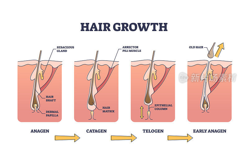 毛发生长过程各阶段解剖结构示意图