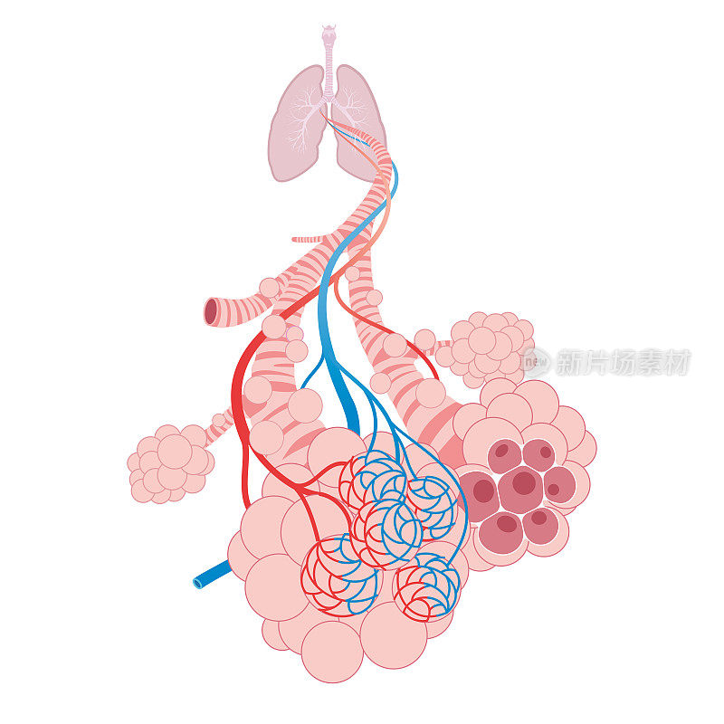肺泡肺中的肺泡、气管和细支气管