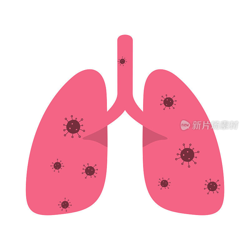 感染冠状病毒的人肺部