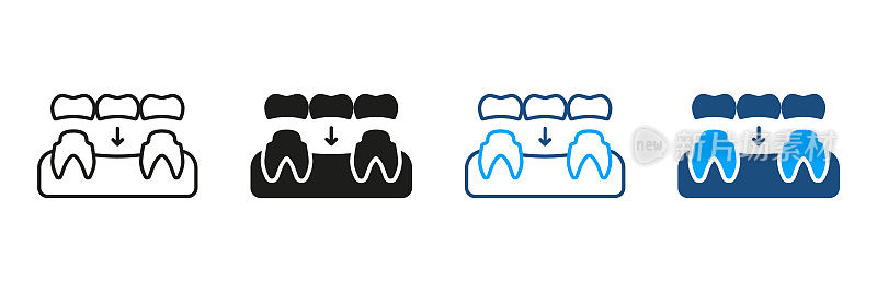 牙科桥轮廓和线条图标集。瓷义齿，牙齿再生象形图。部分牙种植体修复。牙科治疗标志收藏。孤立矢量图