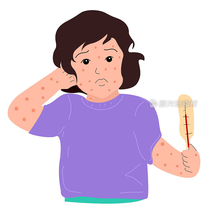 一个患水痘的女孩出了疹子全身发痒。