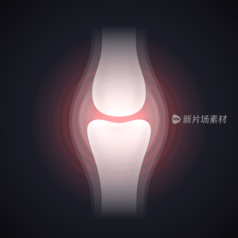 膝关节疼痛或损伤x光片