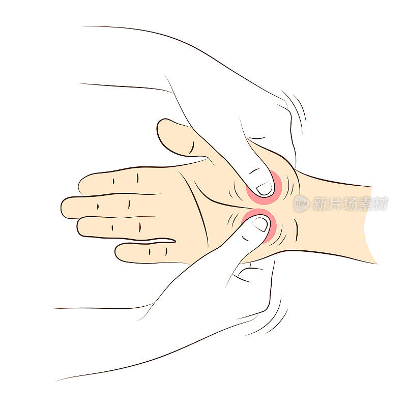 手按摩,特写。理疗师按女性手掌上的特殊穴位，以缓解头痛等疼痛。健康和健康穴位按摩手法。替代医学,反射学