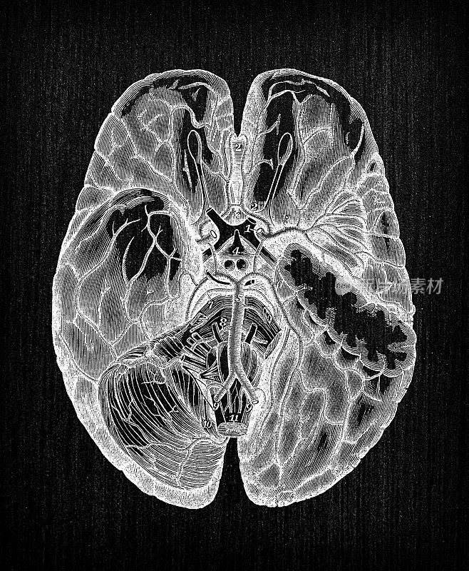 人体解剖学古董插图:脑动脉