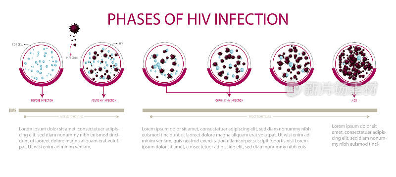 艾滋病毒感染的阶段。CD24细胞。