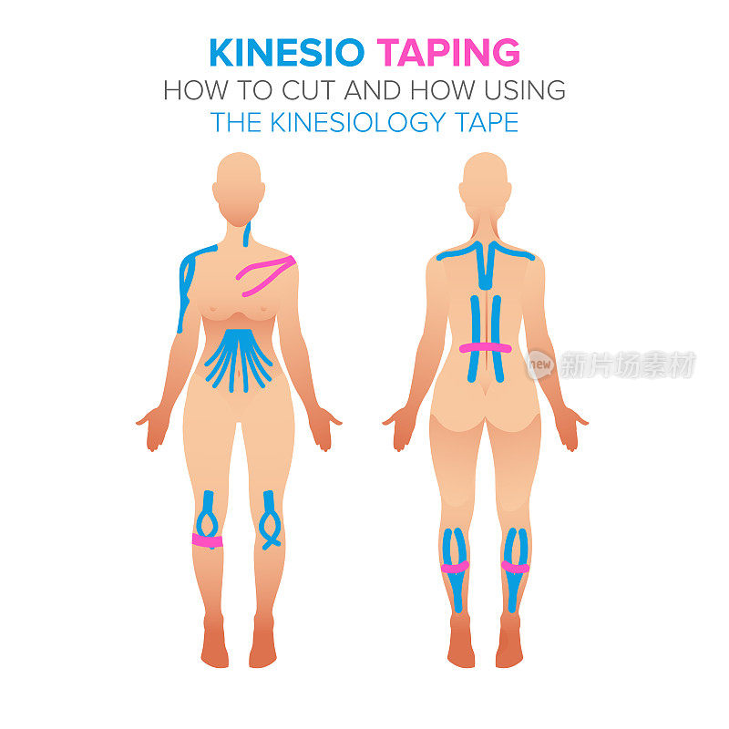 Kinesio录制插图。如何使用和如何切断运动机能学胶带。女性身体