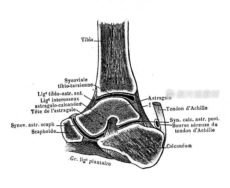 Tibial-tarsal矢状切面