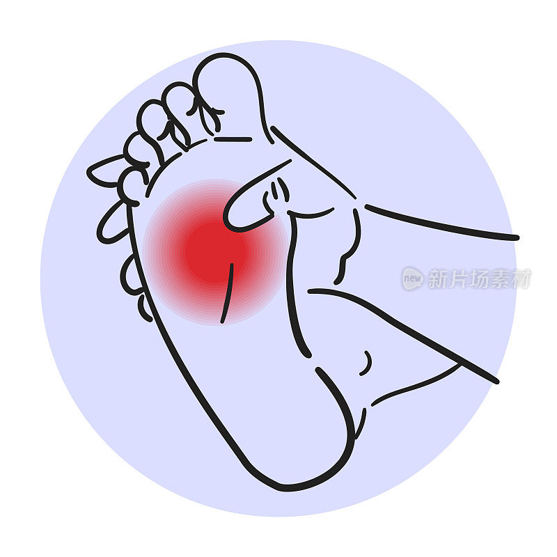 足部疼痛载体隔离。医学上的说明，身体上的伤害