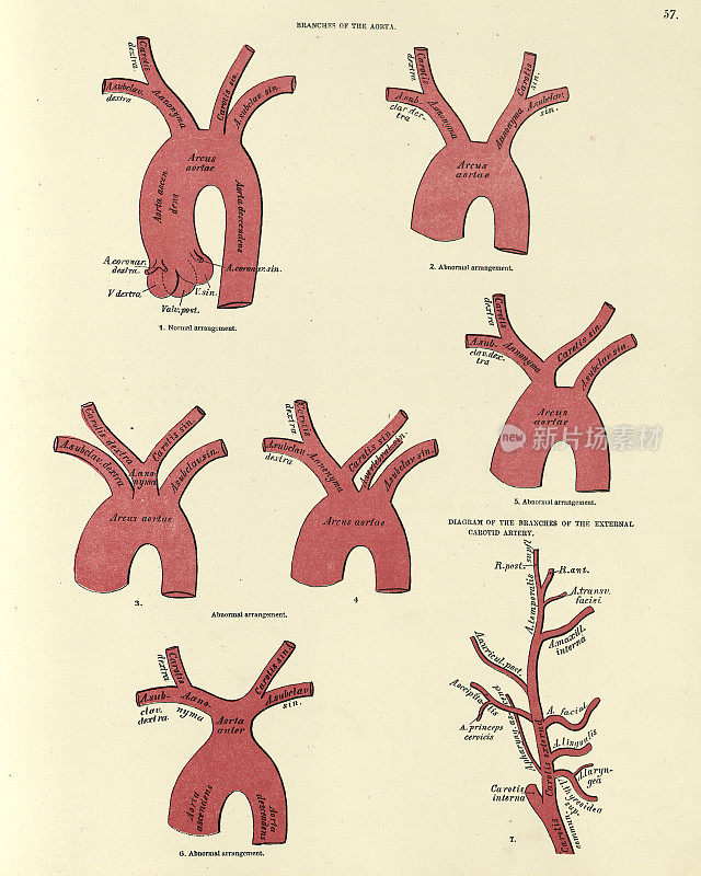 人体解剖学，主动脉的分支，维多利亚时代的解剖学画
