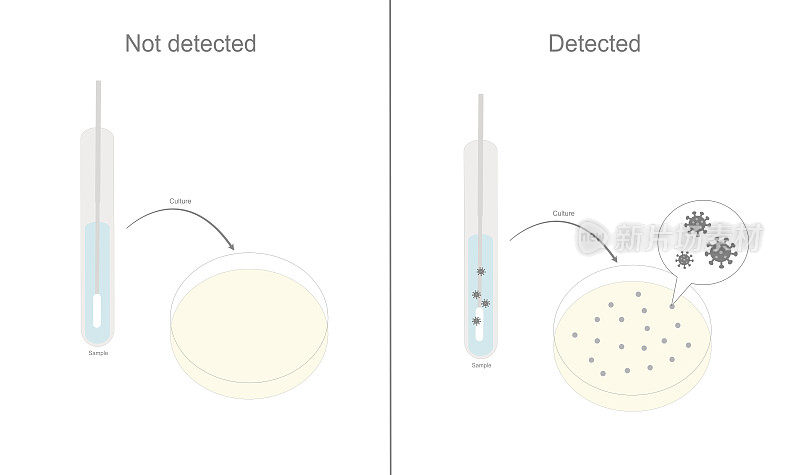 用拭子棒在试管中对未知样本进行病原培养(病毒、细菌等)的结果，表明已检测到或未检测到。