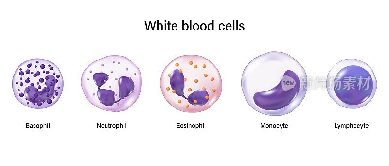 白细胞的类型。嗜碱性粒细胞，中性粒细胞，嗜酸性粒细胞，单核细胞和淋巴细胞。白细胞。血细胞教育医学信息。