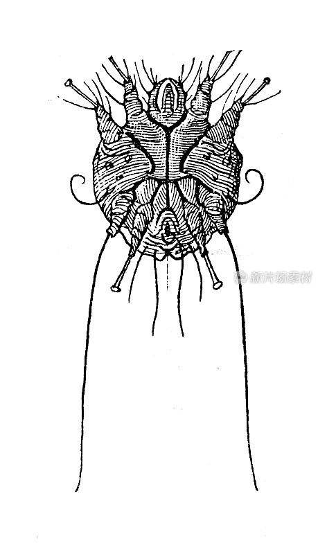 古董插图:疥螨，疥疮螨