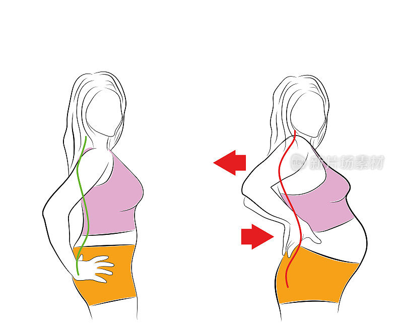 怀孕的女人。背痛。矢量插图。