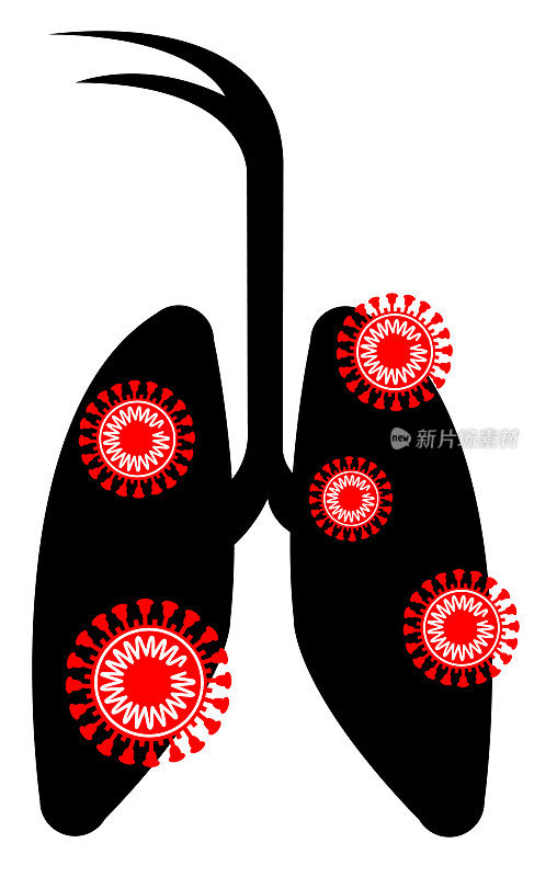 COVID-19、冠状病毒、阻止传播、肺部图形