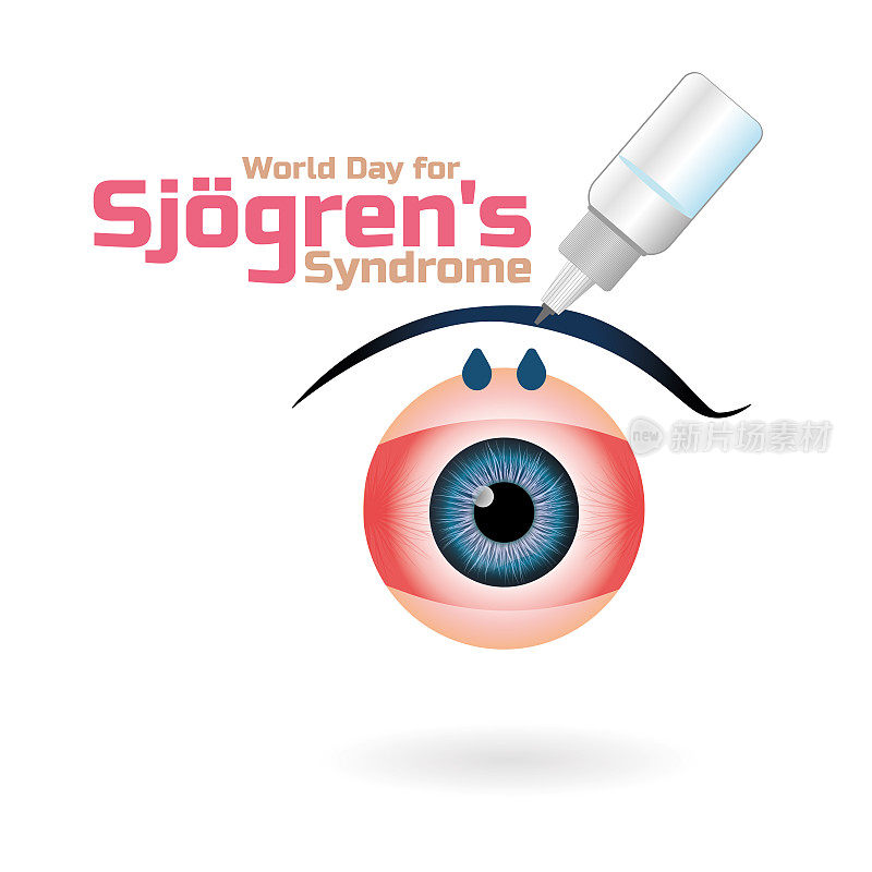 世界Sjögren综合征日，在白色背景下，用人工泪液湿润眼睛。