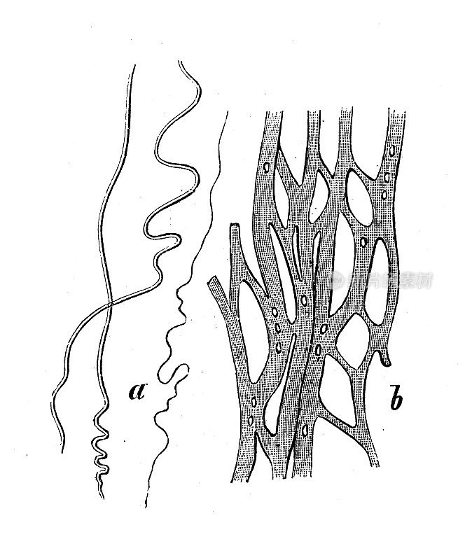 仿古生物动物学图像:弹性纤维，网络