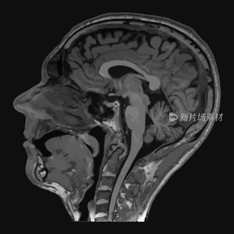 男性头部矢状面CT、MRI磁共振成像层。孤立在黑暗的背景。
